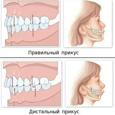 Человеческие зубы: Скачать WebP