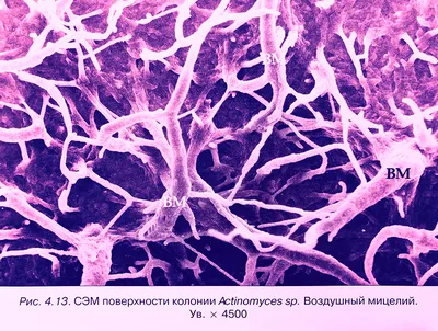 Человеческий актиномикоз: Фотографии для изучения