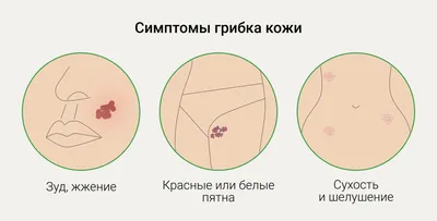 Фотографии актиномикоза: Визуализация проблемы