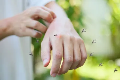 Фото аллергической реакции на укус комара: скачать бесплатно