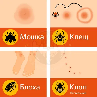 Фото аллергической реакции на укус комара: что делать при аллергии