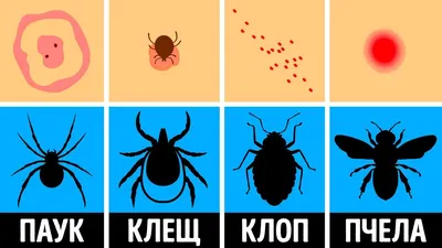 Аллергическая реакция на укус комара: фотографии и интересные факты