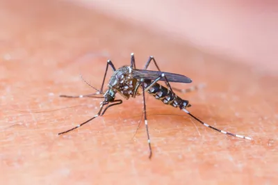 Укус комара и аллергия: фото и объяснение