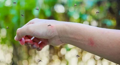 Фотк аллергии на укус комара у ребенка