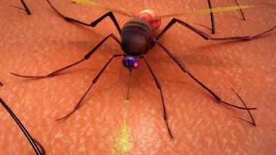 Аллергия на укусы комаров и мошек: фото и симптомы аллергической реакции