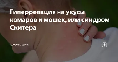 Фото аллергии на укусы комаров и мошек: как снять зуд и воспаление