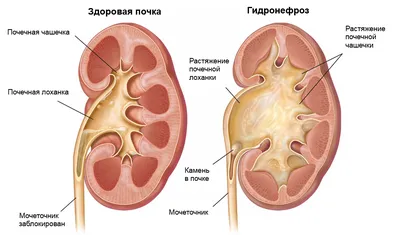 Визуализация анатомии: выберите размер и формат для фото почек