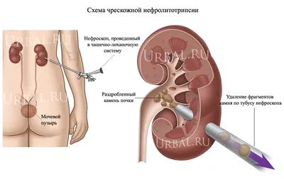 Фотогалерея почек: выберите изображение по своему вкусу