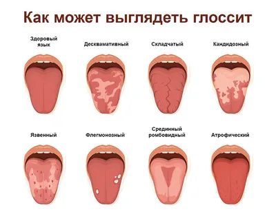 Изображения языка человека: разнообразие форматов и размеров