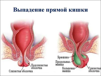 Фото анатомии кишечника человека: Изображение в разных размерах в PNG