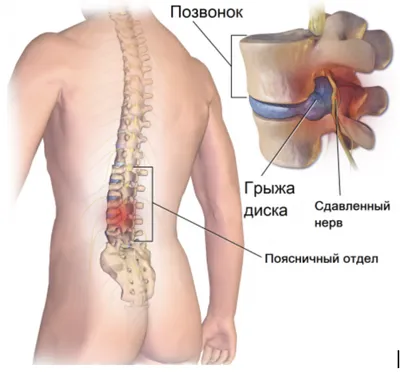 Изображение человеческого позвоночника: Скачивание в JPG, PNG, WebP