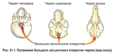 Атавизмы у человека: Фотографии древних закодированных форм