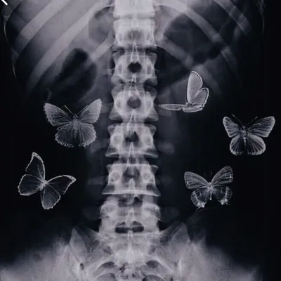 Бабочки в животе  фото