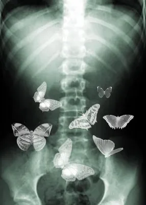 Разнообразие бабочек в животе