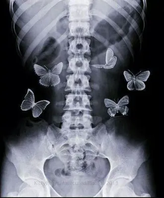 Изящные мотыльки на странице Бабочки в животе