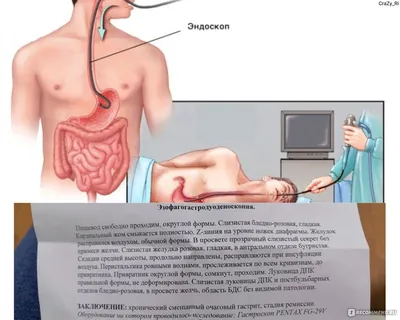 Фотография с необычной реакцией на что-то: JPG для различных экранов