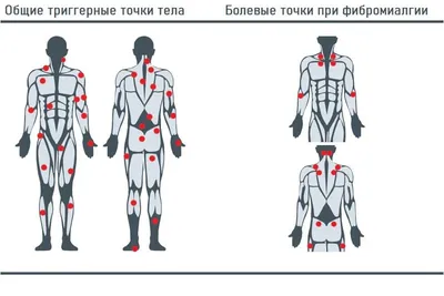 Картинки болевых точек: Формат WebP для загрузки