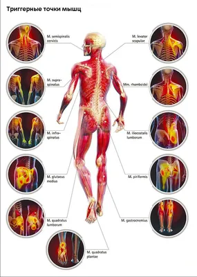 Фото человеческих болевых точек: PNG для скачивания