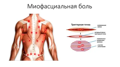 Фото болезненных точек: Изображения в JPG для разных размеров