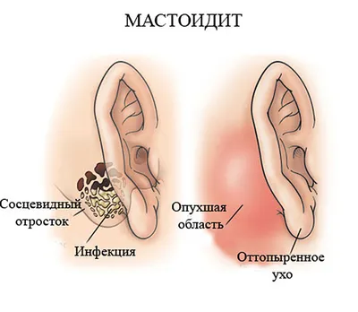 Картинки и диагноз болезней ушной раковины