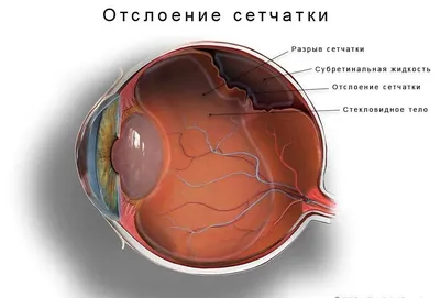 Картинка: Фотография болезней век у человека в PNG для скачивания