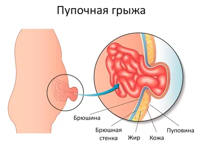 17. Формат по вашему желанию: Большие яйца у человека в WebP