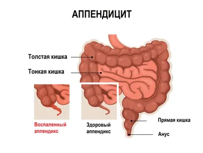 Фотография Брюшина человека: Скачать WebP