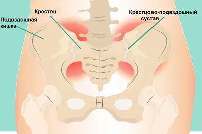 Бруцеллез человека: изображение в WebP