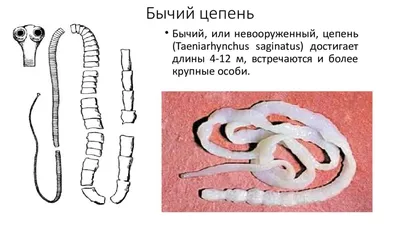 Впечатляющие снимки: Человек и его бычий цепень