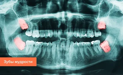 Челюсть человека: Зубы в высоком разрешении