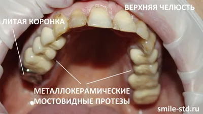 Выберите формат: Фото челюсти с удивительными зубами