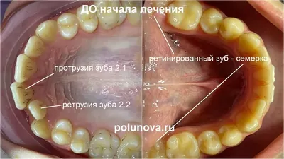 Фотографии человеческих зубов: Выберите формат для скачивания