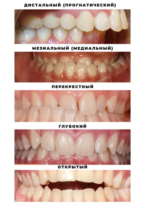 Изображения челюсти: Зубы в JPG, PNG, WebP форматах