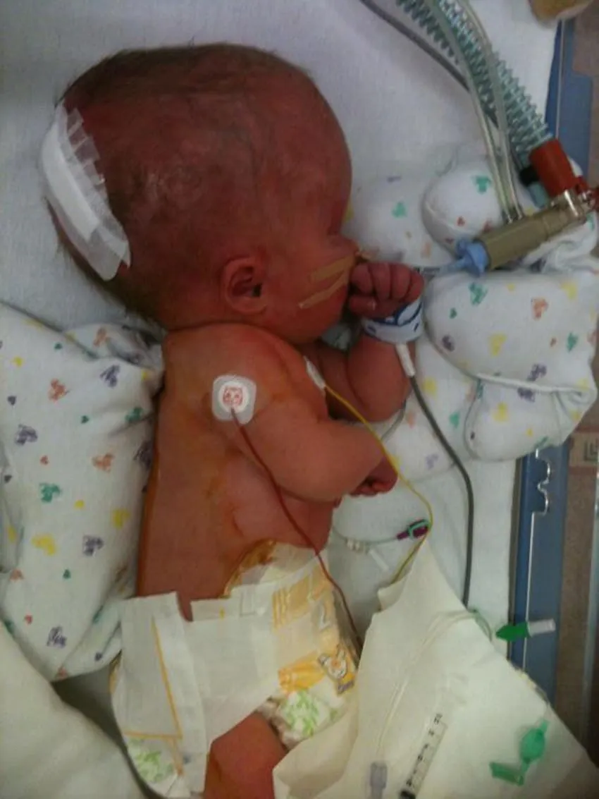 Ребёнок который родился без головного мозга. Фото спустя 5 лет | звезды сенсации | Дзен