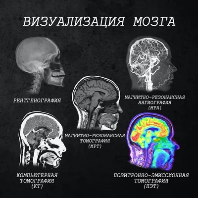 Пиксельные контуры: Фото Человека без мозга в различных разрешениях