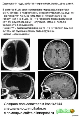 Взгляд в пустоту: Изображения Человека без мозга для вашего экрана