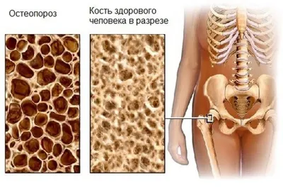 Фотография Человека: Выберите свой идеальный размер и формат