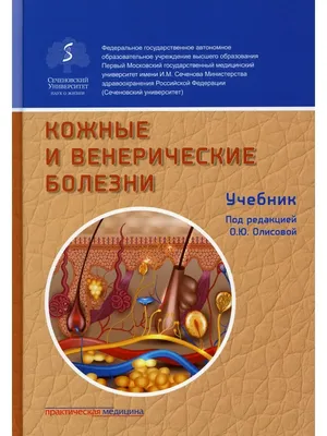 Черная роза-венерическое заболевание - фото в формате webp