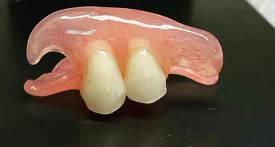 Впечатляющие бабочки в стоматологии: фотографии с деталями