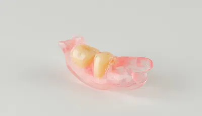 Фото бабочки в стоматологии: уникальные картинки на зубах