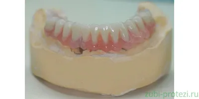 Уникальные фотографии бабочек в стоматологии: оригинальные рисунки на зубах