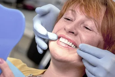 Фото бабочки в стоматологии: удивительные и креативные картинки на зубах