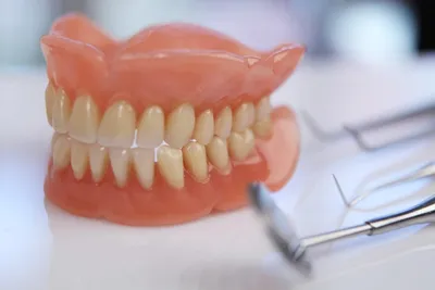 Бабочка в стоматологии: замысловатые узоры и рисунки на зубах