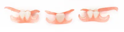 Бабочка в стоматологии: качественные рисунки и детали на зубах