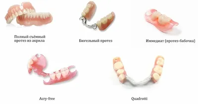 Бабочка в стоматологии: красивые узоры и рисунки на зубах
