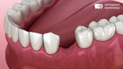 Бабочка в стоматологии: удивительные узоры и картины на зубах