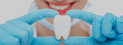 Фото бабочки в стоматологии: детализированные и оригинальные картинки на зубах