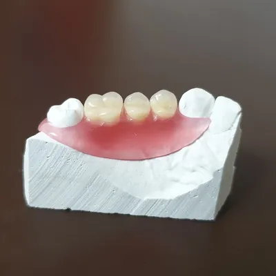 Бабочка в стоматологии: уникальные рисунки и детали на зубах