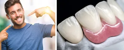 Фото бабочки в стоматологии: удивительные и выразительные картинки на зубах