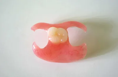 Бабочка в стоматологии: уникальные узоры и картины на зубах